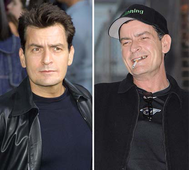 8 celebridades antes e depois das drogas - Fatos Desconhecidos